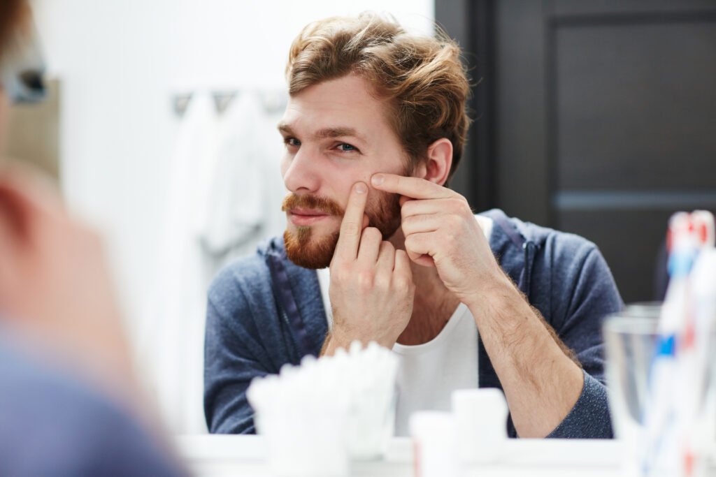 Adult man looking at a red pimple on his cheek in the mirror